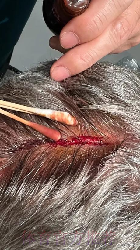 安帅:输球责任在我 马竞领先2球让一切都变得困难